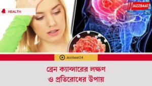ব্রেন ক্যান্সারের লক্ষণ ও প্রতিরোধের উপায়