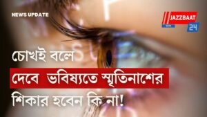 চোখই বলে দেবে ভবিষ্যতে স্মৃতিনাশের শিকার হবেন কি না!
