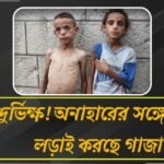 ভয়ঙ্কর দুর্দশা গাজায়, খাবার না পেয়ে অপুষ্টিতে মৃত্যু শিশুদের, অবরোধে হাহাকার মানুষের