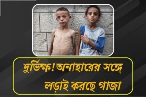 ভয়ঙ্কর দুর্দশা গাজায়, খাবার না পেয়ে অপুষ্টিতে মৃত্যু শিশুদের, অবরোধে হাহাকার মানুষের