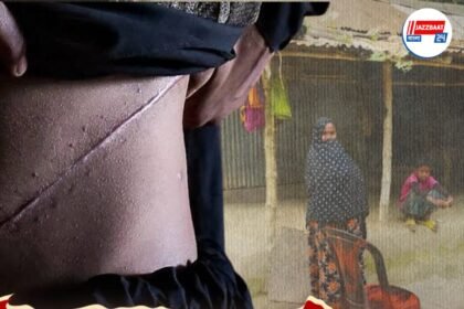 পেটের টানে কলকাতায় এসে কিডনি বিক্রি! বাংলাদেশের এই গ্রাম বড় অদ্ভুত