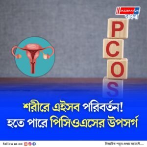 পিরিয়ডস শুরু হওয়ার আগেই দেখা দিতে পারে পিসিওএসের উপসর্গ